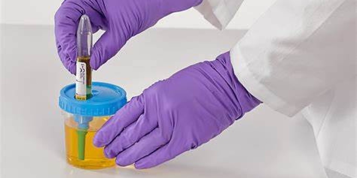 Trust Clinfinite Solutions for Safe Urine Sample Testing