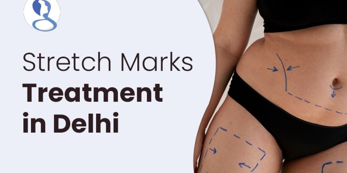 How Does A Laser Work In Stretch Marks Removal?