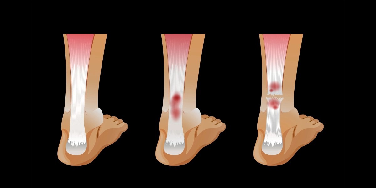 Fractured Bone Treatment in Hyderabad | Dr. Aditya Kapoor :