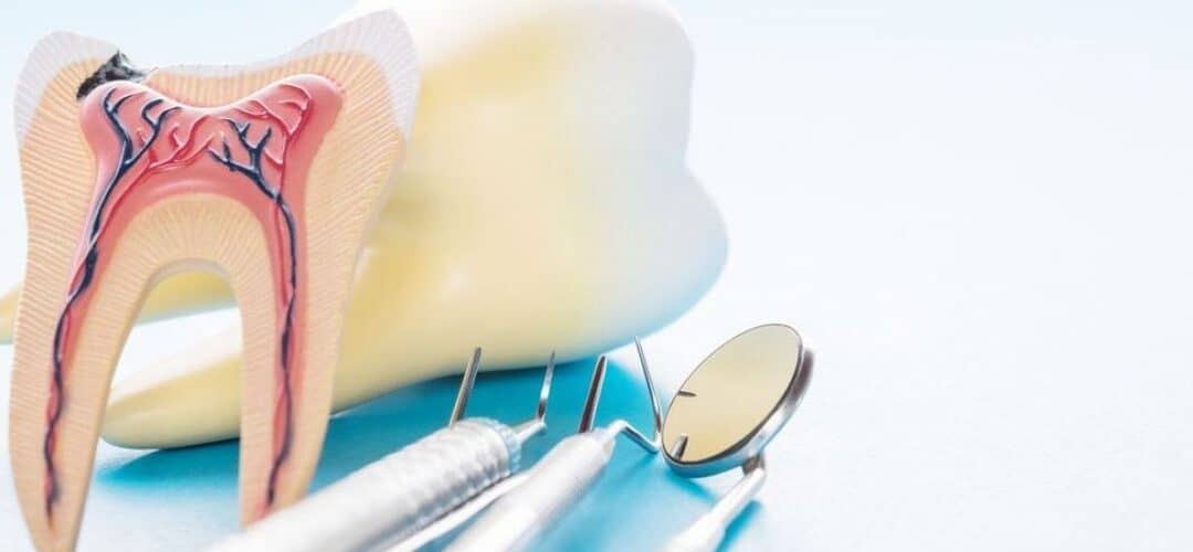 Benefits of Getting Dental Implants | TheAmberPost