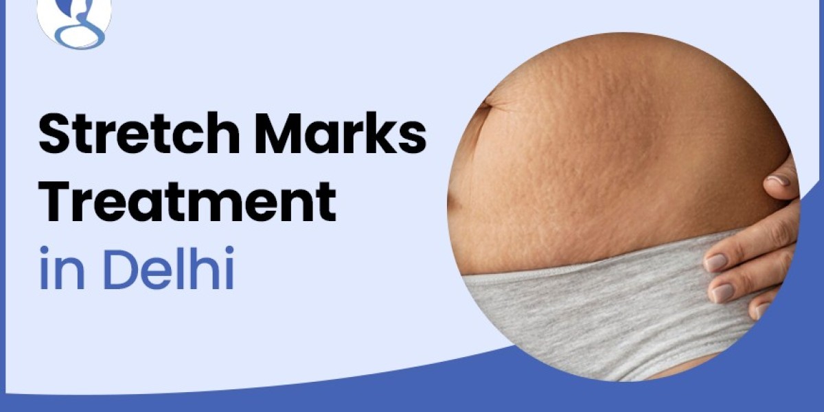 How Can a Dermatologist Help You with Shoulder Stretch Marks Removal?