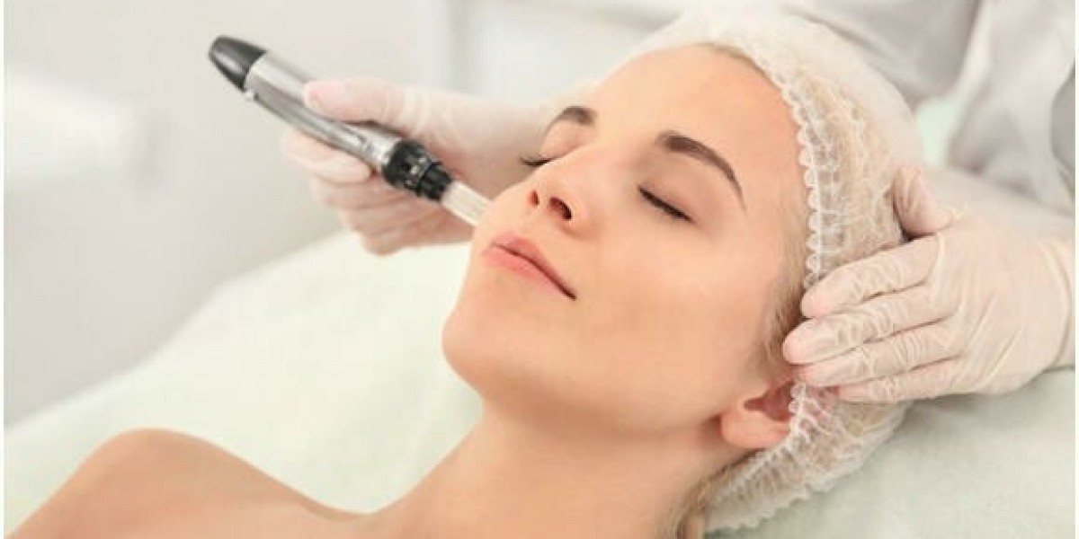 What to Expect During Your First Microneedling Session