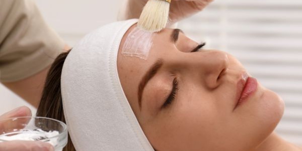 How Often Should You Get Chemical Peels?