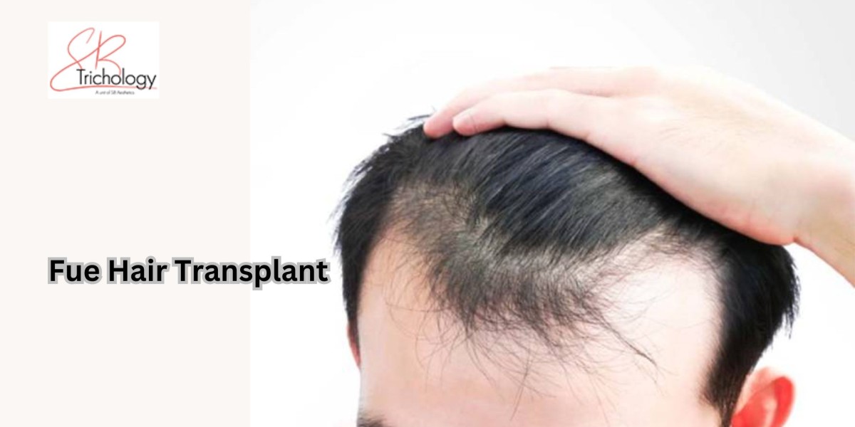 Aftercare Tips for a Successful Hair Transplant Recovery