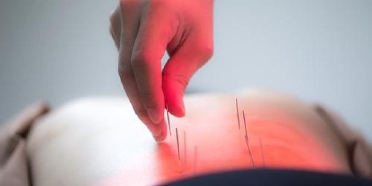 Discover Holistic Healing: Acupuncture in Morristown at CM Harmony!