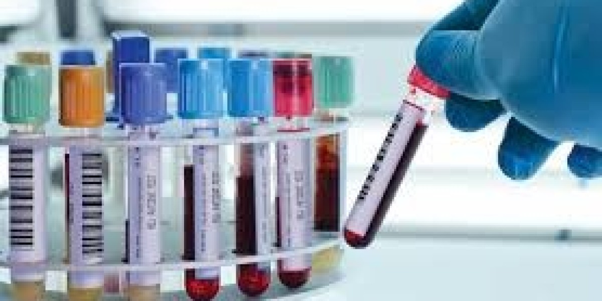  Principle of Blood Collection at Clinfinite Solutions