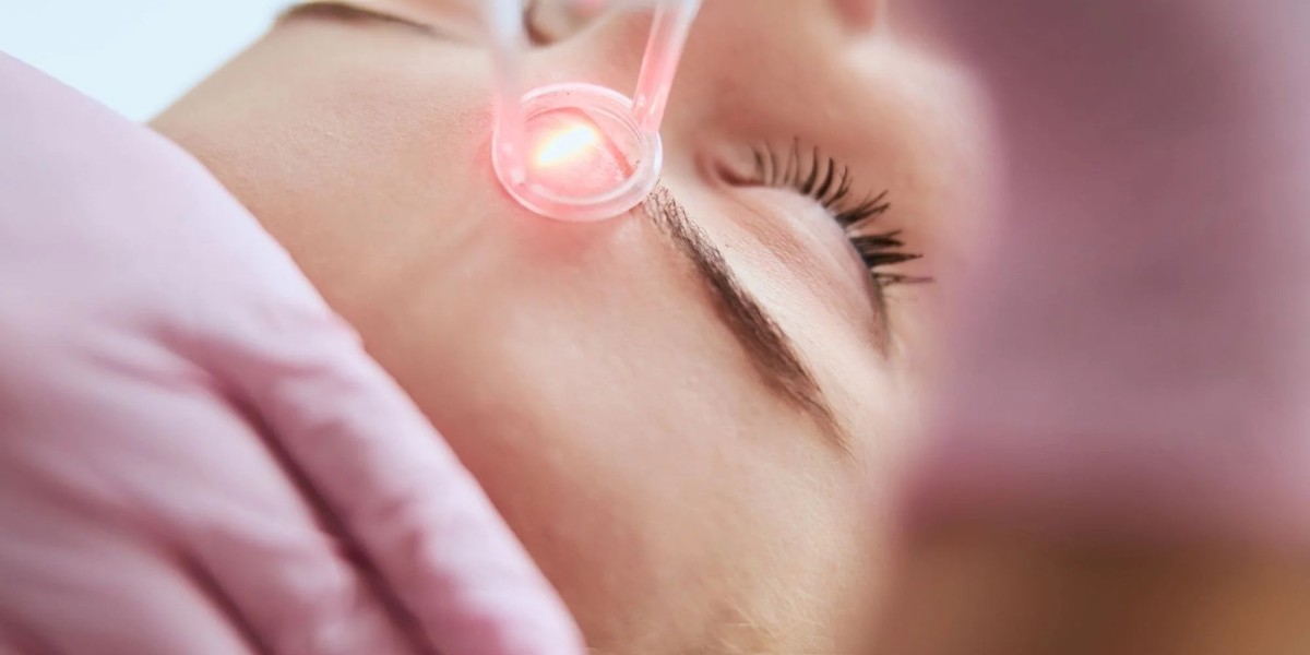 The Rise of Laser Treatments for Facial Rejuvenation