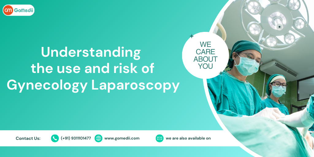 Understanding the Use and Risks of Gynecology Laparoscopy - GoMedii