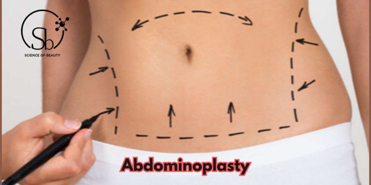 A Short Patient’s Guide to Abdominoplasty